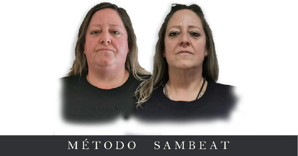 Elsa Dominguez Metopa cara antes y despues sin frase