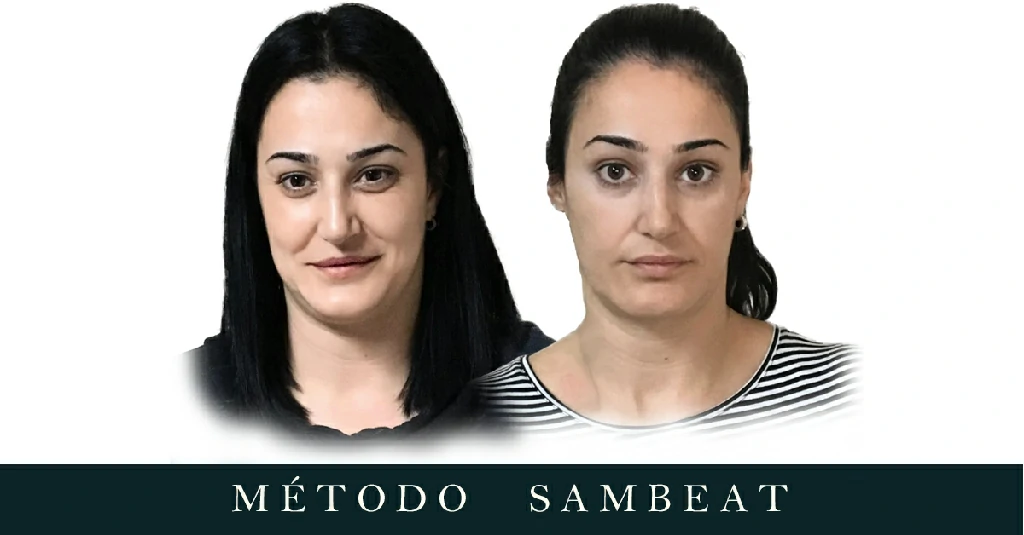 Sonia Sotillos Metopa cara antes y despues